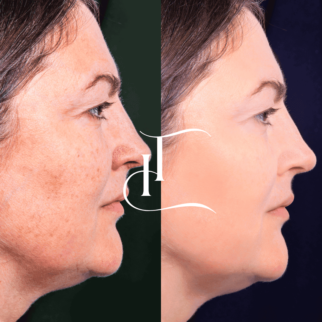 Especialista-em-Harmonizacao-Facial-19 (1) (1)