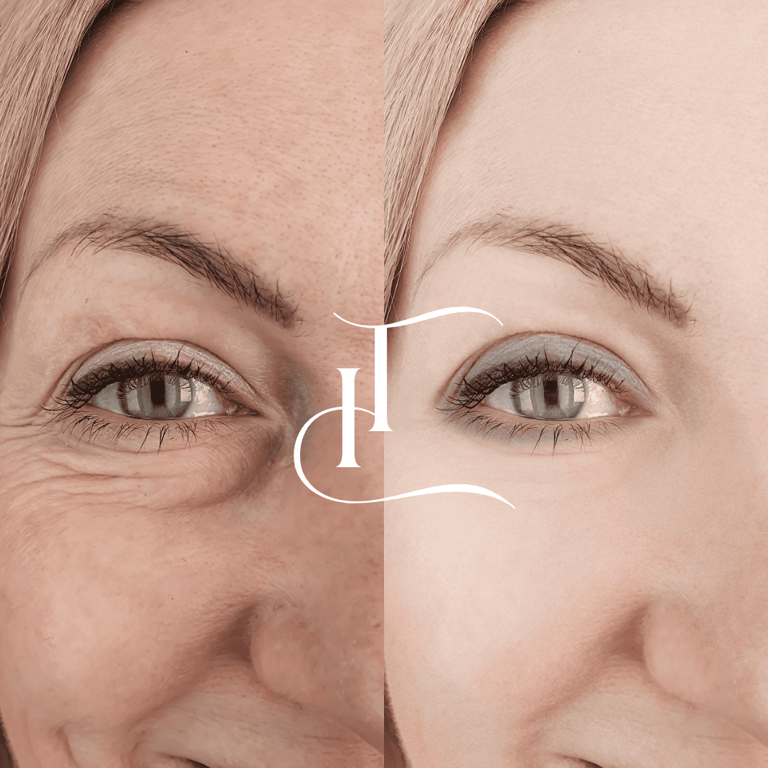 Especialista-em-Harmonizacao-Facial-2-1 (1)