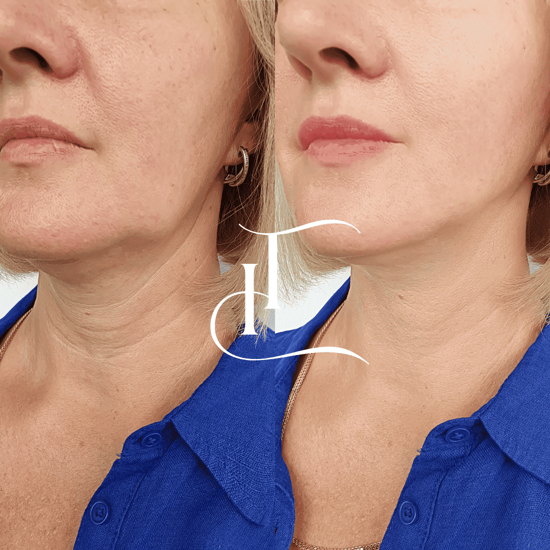 Especialista-em-Harmonizacao-Facial-5-1 (1) (1)